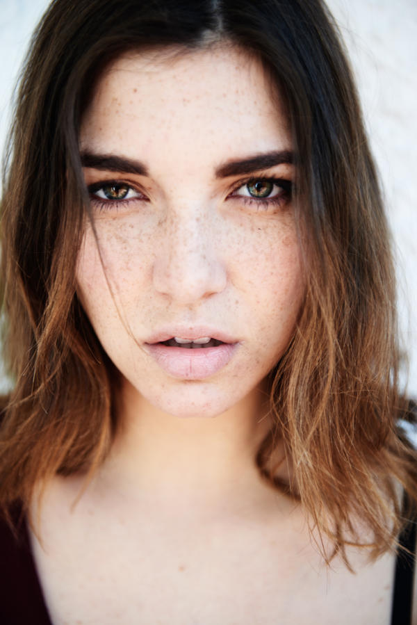 freckled woman
