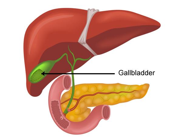 How to Flush Gallbladder Sludge Naturally in Safe and Effective Ways