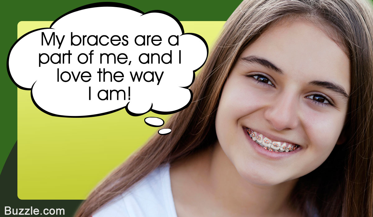 How to Look Good with Braces