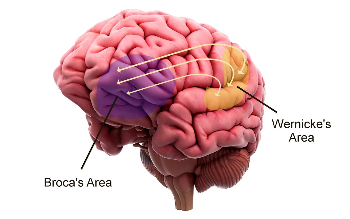 Tất tần tật về phục hồi chức năng ngôn ngữ sau tai biến mạch máu não tại nhà  - Ảnh 2.